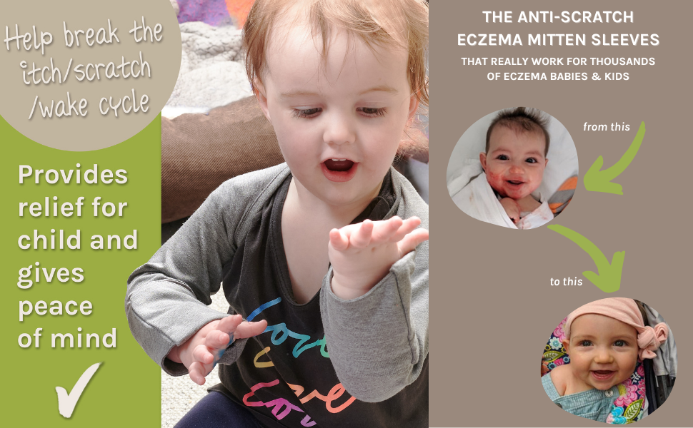 eczema mitten scratch sleeve for babies and toddlers